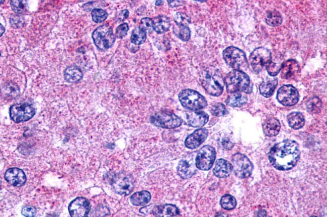 PTGER2 Antibody in Immunohistochemistry (Paraffin) (IHC (P))