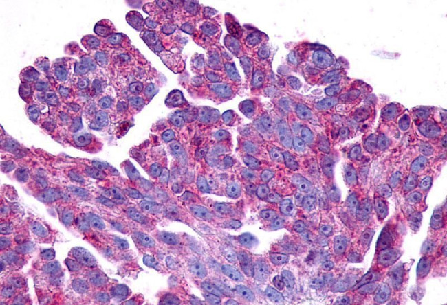 PTGER2 Antibody in Immunohistochemistry (Paraffin) (IHC (P))