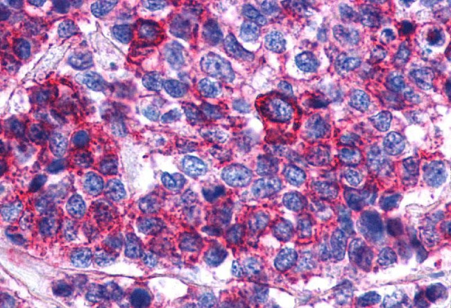 PTGER2 Antibody in Immunohistochemistry (Paraffin) (IHC (P))