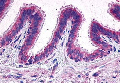 PTGER2 Antibody in Immunohistochemistry (Paraffin) (IHC (P))