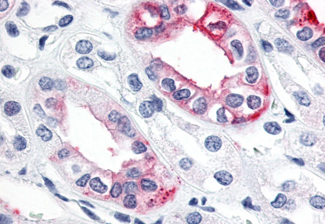 ESRRG Antibody in Immunohistochemistry (Paraffin) (IHC (P))