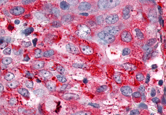 ESRRG Antibody in Immunohistochemistry (Paraffin) (IHC (P))