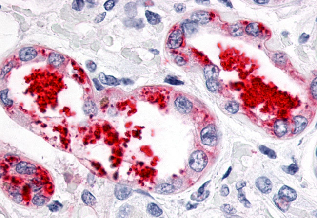 ESRRG Antibody in Immunohistochemistry (Paraffin) (IHC (P))