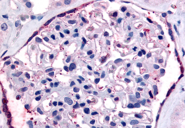 PAR2 Antibody in Immunohistochemistry (Paraffin) (IHC (P))