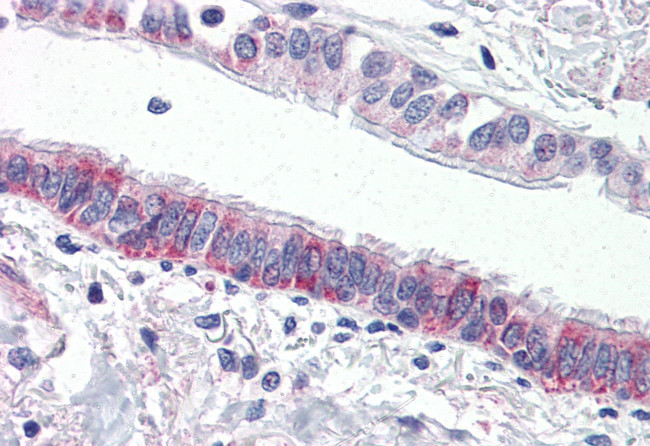 Protease-Activated Receptor-4 Antibody in Immunohistochemistry (Paraffin) (IHC (P))