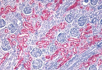 FZD10 Antibody in Immunohistochemistry (Paraffin) (IHC (P))