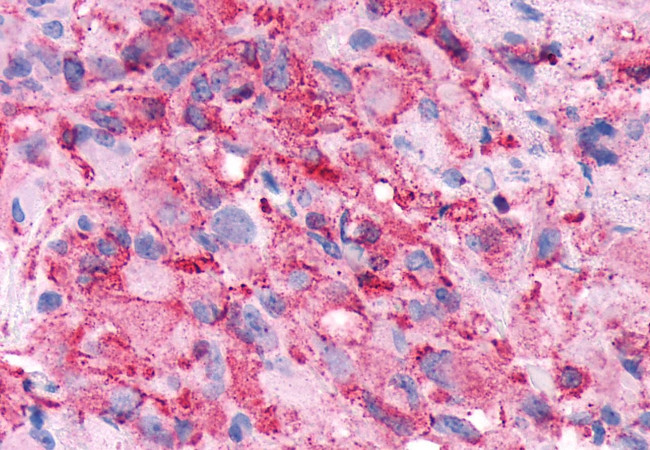 FZD5 Antibody in Immunohistochemistry (Paraffin) (IHC (P))