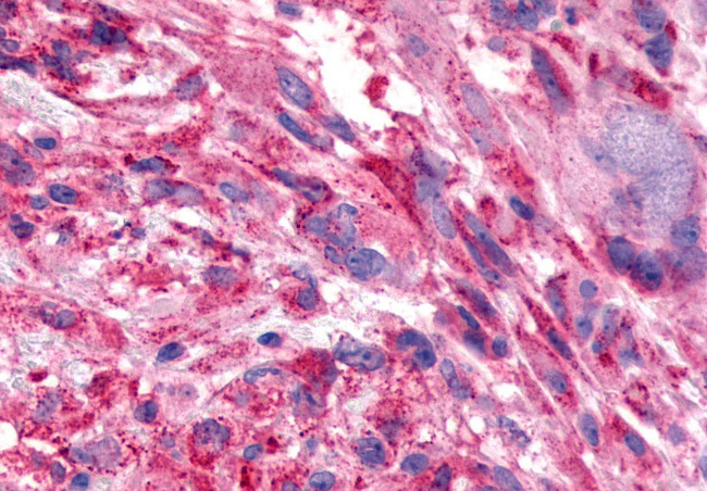 FZD7 Antibody in Immunohistochemistry (Paraffin) (IHC (P))