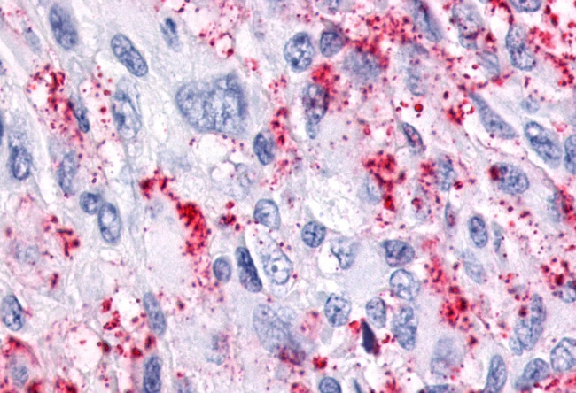 GPR116 Antibody in Immunohistochemistry (Paraffin) (IHC (P))