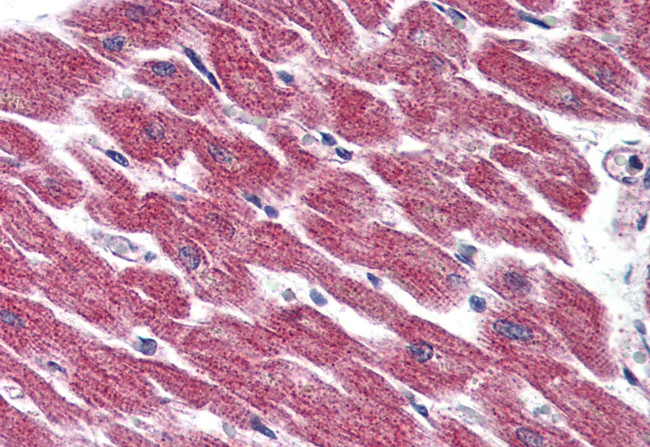 GPR116 Antibody in Immunohistochemistry (Paraffin) (IHC (P))