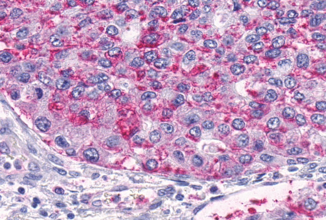 TEM5 Antibody in Immunohistochemistry (Paraffin) (IHC (P))