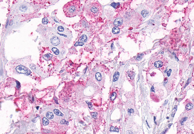 TEM5 Antibody in Immunohistochemistry (Paraffin) (IHC (P))