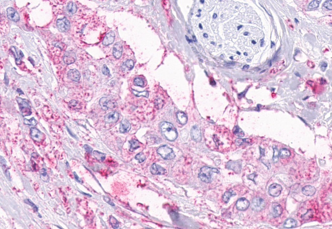 TEM5 Antibody in Immunohistochemistry (Paraffin) (IHC (P))