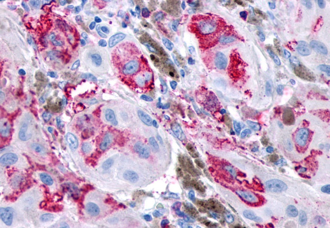 GPR161 Antibody in Immunohistochemistry (Paraffin) (IHC (P))