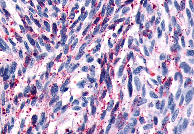 GPR161 Antibody in Immunohistochemistry (Paraffin) (IHC (P))