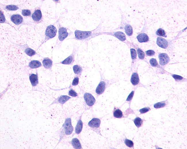 CRTH2 Antibody in Immunocytochemistry (ICC/IF)