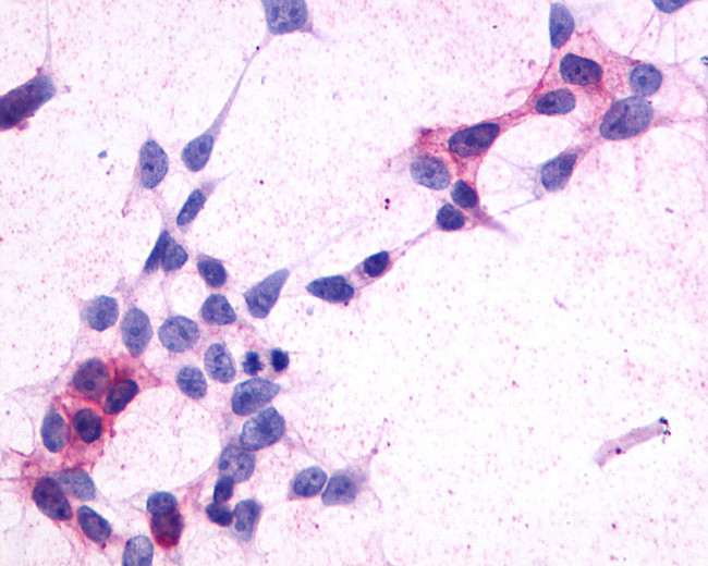 CRTH2 Antibody in Immunocytochemistry (ICC/IF)