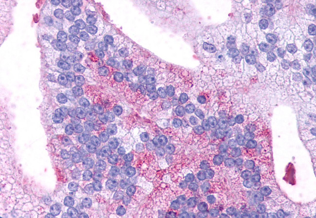 GPR88 Antibody in Immunohistochemistry (Paraffin) (IHC (P))