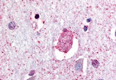 GPR88 Antibody in Immunohistochemistry (Paraffin) (IHC (P))