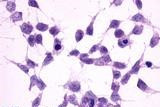 mGluR2 Antibody in Immunocytochemistry (ICC/IF)