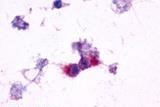 mGluR2 Antibody in Immunocytochemistry (ICC/IF)