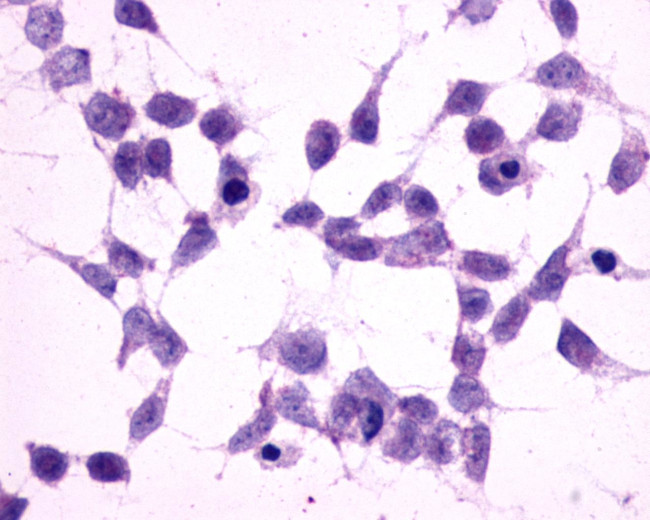 mGluR2 Antibody in Immunocytochemistry (ICC/IF)