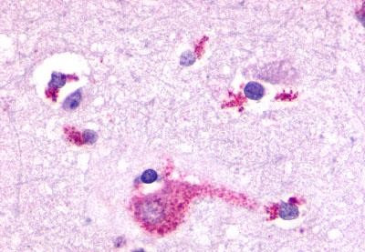 mGluR2 Antibody in Immunohistochemistry (Paraffin) (IHC (P))