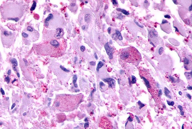 mGluR2 Antibody in Immunohistochemistry (Paraffin) (IHC (P))