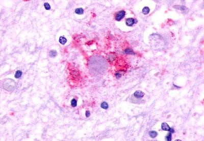 mGluR2 Antibody in Immunohistochemistry (Paraffin) (IHC (P))