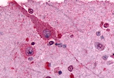 mGluR2 Antibody in Immunohistochemistry (Paraffin) (IHC (P))