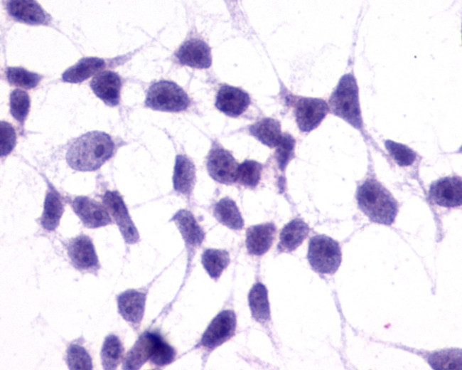 mGluR3 Antibody in Immunocytochemistry (ICC/IF)