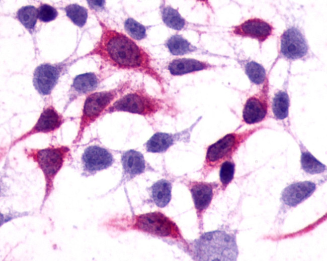 mGluR3 Antibody in Immunocytochemistry (ICC/IF)