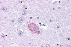 mGluR3 Antibody in Immunohistochemistry (Paraffin) (IHC (P))