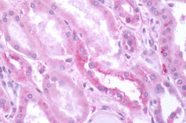 mGluR3 Antibody in Immunohistochemistry (Paraffin) (IHC (P))