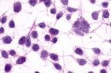 mGluR3 Antibody in Immunocytochemistry (ICC/IF)