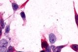 mGluR3 Antibody in Immunocytochemistry (ICC/IF)