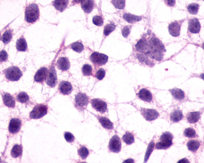 mGluR3 Antibody in Immunocytochemistry (ICC/IF)