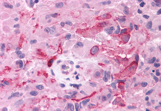 mGluR3 Antibody in Immunohistochemistry (Paraffin) (IHC (P))