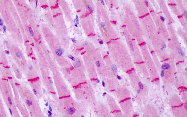 mGluR8 Antibody in Immunohistochemistry (Paraffin) (IHC (P))