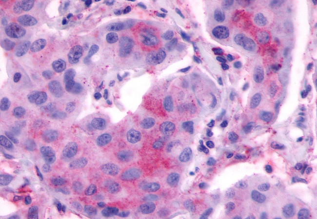 LHR Antibody in Immunohistochemistry (Paraffin) (IHC (P))