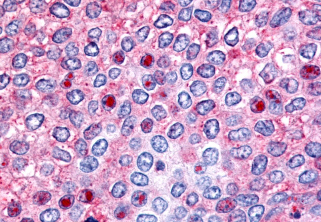 HNF4G Antibody in Immunohistochemistry (Paraffin) (IHC (P))