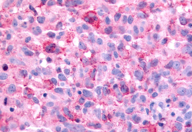 HNF4G Antibody in Immunohistochemistry (Paraffin) (IHC (P))