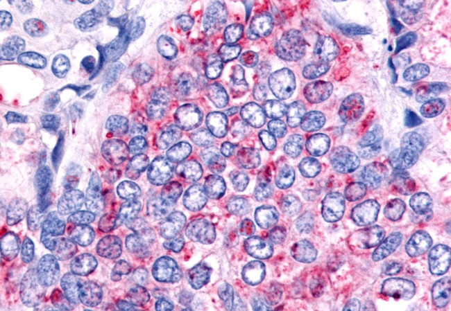 HNF4G Antibody in Immunohistochemistry (Paraffin) (IHC (P))