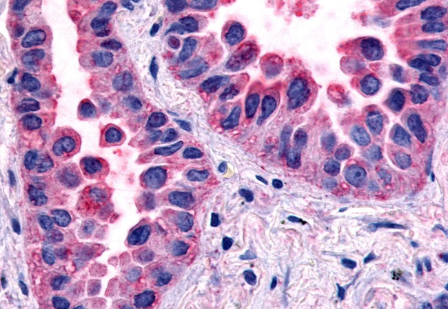 HNF4G Antibody in Immunohistochemistry (Paraffin) (IHC (P))