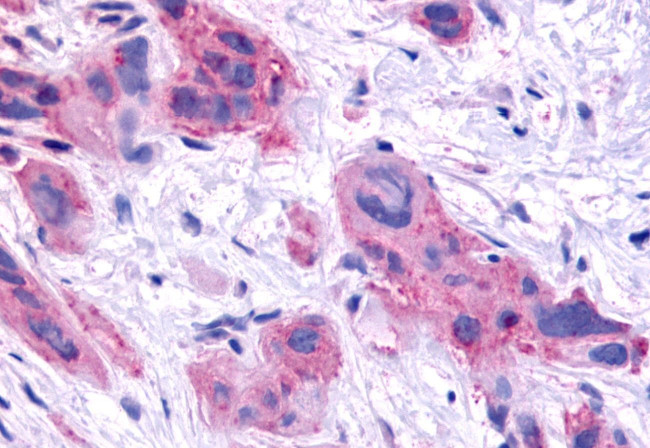 HNF4G Antibody in Immunohistochemistry (Paraffin) (IHC (P))