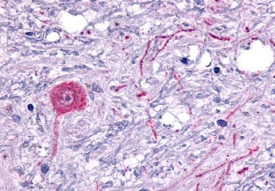 HTR6 Antibody in Immunohistochemistry (Paraffin) (IHC (P))