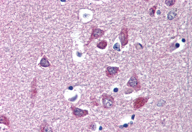 KV1.3 (KCNA3) Antibody in Immunohistochemistry (Paraffin) (IHC (P))