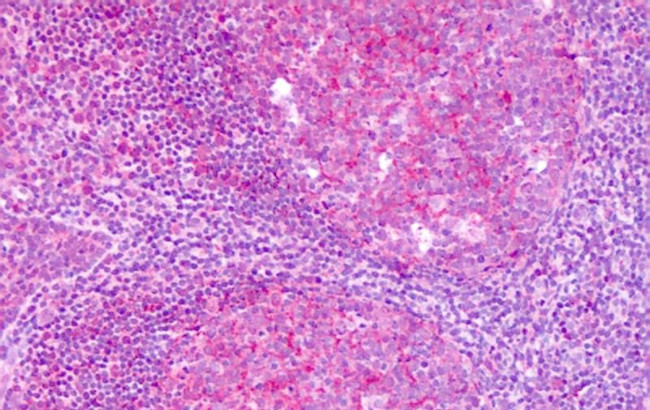 KISS1R Antibody in Immunohistochemistry (Paraffin) (IHC (P))