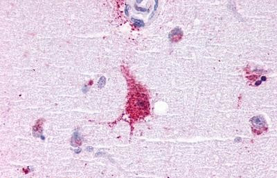 LGR6 Antibody in Immunohistochemistry (Paraffin) (IHC (P))