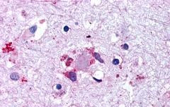 LGR6 Antibody in Immunohistochemistry (Paraffin) (IHC (P))